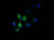 Solute Carrier Family 30 Member 3 antibody, M06208, Boster Biological Technology, Immunofluorescence image 