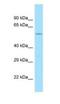 CCZ1 Homolog, Vacuolar Protein Trafficking And Biogenesis Associated antibody, NBP1-98558, Novus Biologicals, Western Blot image 