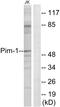 Pim-1 Proto-Oncogene, Serine/Threonine Kinase antibody, LS-C117770, Lifespan Biosciences, Western Blot image 