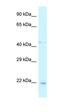 Twist Family BHLH Transcription Factor 1 antibody, orb329954, Biorbyt, Western Blot image 