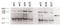 Terminal Uridylyl Transferase 4 antibody, STJ72647, St John