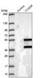 CXADR Ig-Like Cell Adhesion Molecule antibody, NBP1-88194, Novus Biologicals, Western Blot image 