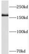 THADA Armadillo Repeat Containing antibody, FNab08657, FineTest, Western Blot image 