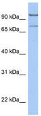 Leucine Carboxyl Methyltransferase 2 antibody, TA346775, Origene, Western Blot image 