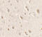 Unc-51 Like Autophagy Activating Kinase 1 antibody, A00584, Boster Biological Technology, Immunohistochemistry paraffin image 