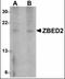 Zinc Finger BED-Type Containing 2 antibody, orb94278, Biorbyt, Western Blot image 