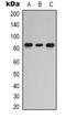 Protein Kinase C Epsilon antibody, orb338980, Biorbyt, Western Blot image 