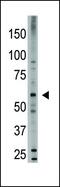 Bone Morphogenetic Protein 6 antibody, PA5-11719, Invitrogen Antibodies, Western Blot image 