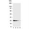 Growth Hormone 1 antibody, R30126, NSJ Bioreagents, Western Blot image 