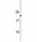 Cyclin Dependent Kinase Inhibitor 1B antibody, F52107-0.4ML, NSJ Bioreagents, Western Blot image 