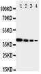 Erb-B2 Receptor Tyrosine Kinase 4 antibody, PA1881, Boster Biological Technology, Western Blot image 