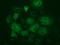 Fumarylacetoacetate Hydrolase Domain Containing 2A antibody, LS-C172335, Lifespan Biosciences, Immunofluorescence image 
