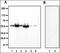 Cytochrome P450 Family 19 Subfamily A Member 1 antibody, NBP2-61939, Novus Biologicals, Western Blot image 