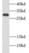 CR antibody, FNab01225, FineTest, Western Blot image 