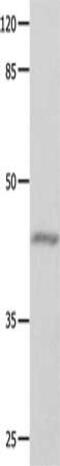 G Protein Subunit Alpha 11 antibody, CSB-PA201320, Cusabio, Western Blot image 