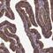 Interferon Related Developmental Regulator 2 antibody, PA5-66999, Invitrogen Antibodies, Immunohistochemistry paraffin image 