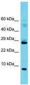 Splicing Factor 3b Subunit 5 antibody, TA343080, Origene, Western Blot image 