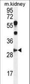 Cyclin G1 antibody, LS-C168471, Lifespan Biosciences, Western Blot image 