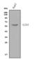 Solute Carrier Family 2 Member 10 antibody, A06461-2, Boster Biological Technology, Western Blot image 