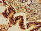 Growth Factor Receptor Bound Protein 10 antibody, LS-C670716, Lifespan Biosciences, Immunohistochemistry paraffin image 