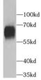 Albumin antibody, FNab00278, FineTest, Western Blot image 