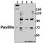 Paxillin antibody, A01033, Boster Biological Technology, Western Blot image 