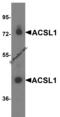 Acyl-CoA Synthetase Long Chain Family Member 1 antibody, 7081, ProSci, Western Blot image 