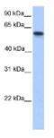 Cytochrome P450 Family 11 Subfamily A Member 1 antibody, ab75497, Abcam, Western Blot image 