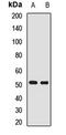 CD55 Molecule (Cromer Blood Group) antibody, LS-C667747, Lifespan Biosciences, Western Blot image 