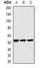 Matrilin 3 antibody, abx225283, Abbexa, Western Blot image 