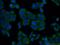 SH2B Adaptor Protein 1 antibody, 12226-1-AP, Proteintech Group, Immunofluorescence image 