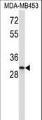 Inhibitor Of Growth Family Member 1 antibody, LS-C165237, Lifespan Biosciences, Western Blot image 