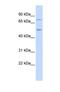 Eukaryotic Translation Initiation Factor 2 Alpha Kinase 1 antibody, NBP1-56484, Novus Biologicals, Western Blot image 