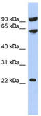 Tigger transposable element-derived protein 3 antibody, TA330967, Origene, Western Blot image 