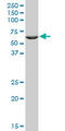 Zinc Finger Protein 133 antibody, LS-C198478, Lifespan Biosciences, Western Blot image 