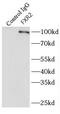 Fragile X mental retardation syndrome-related protein 2 antibody, FNab03257, FineTest, Immunoprecipitation image 