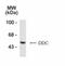 Dopa Decarboxylase antibody, NB300-252, Novus Biologicals, Western Blot image 
