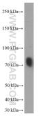 Transferrin antibody, 66171-1-Ig, Proteintech Group, Western Blot image 