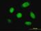 Cathepsin K antibody, H00001513-M01, Novus Biologicals, Immunocytochemistry image 