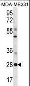 Spi-B Transcription Factor antibody, LS-C156118, Lifespan Biosciences, Western Blot image 