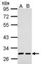 Alpha-1-Microglobulin/Bikunin Precursor antibody, GTX101068, GeneTex, Western Blot image 