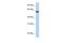 Adhesion Molecule With Ig Like Domain 3 antibody, PA5-44452, Invitrogen Antibodies, Western Blot image 