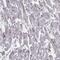 CLN2 antibody, NBP2-48820, Novus Biologicals, Immunohistochemistry frozen image 