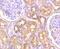 Sodium Voltage-Gated Channel Alpha Subunit 9 antibody, NBP2-75583, Novus Biologicals, Immunohistochemistry paraffin image 