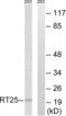 Mitochondrial Ribosomal Protein S25 antibody, LS-C120083, Lifespan Biosciences, Western Blot image 