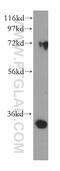 Dehydrogenase/Reductase 3 antibody, 15393-1-AP, Proteintech Group, Western Blot image 