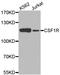 Colony Stimulating Factor 1 Receptor antibody, A3019, ABclonal Technology, Western Blot image 