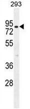 Caseinolytic Mitochondrial Matrix Peptidase Chaperone Subunit antibody, AP50976PU-N, Origene, Western Blot image 