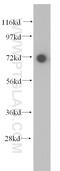 Transmembrane Protein 108 antibody, 15177-1-AP, Proteintech Group, Western Blot image 