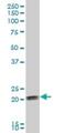 COP9 Signalosome Subunit 8 antibody, H00010920-B01P, Novus Biologicals, Western Blot image 